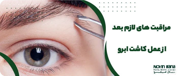 مراقبت های لازم بعد از عمل کاشت ابرو